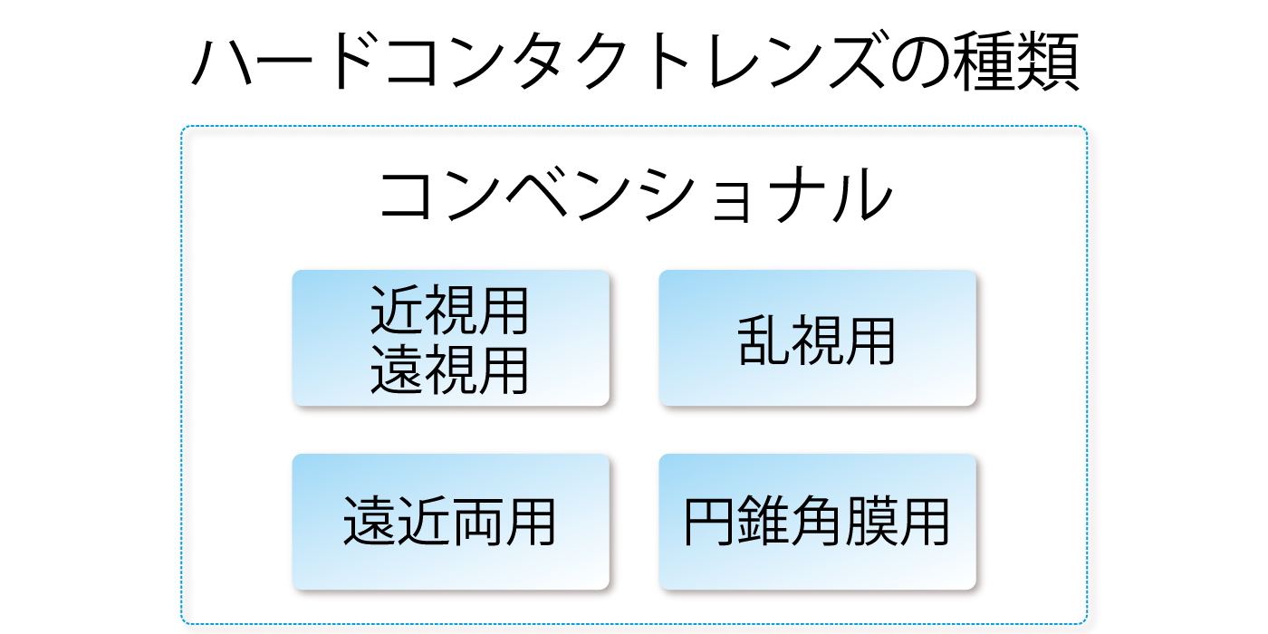 ハードコンタクトレンズの種類